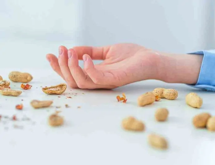 Kenapa Penderita Alergi Kacang Lebih Masif Terjadi di Benua Eropa dan Australia?